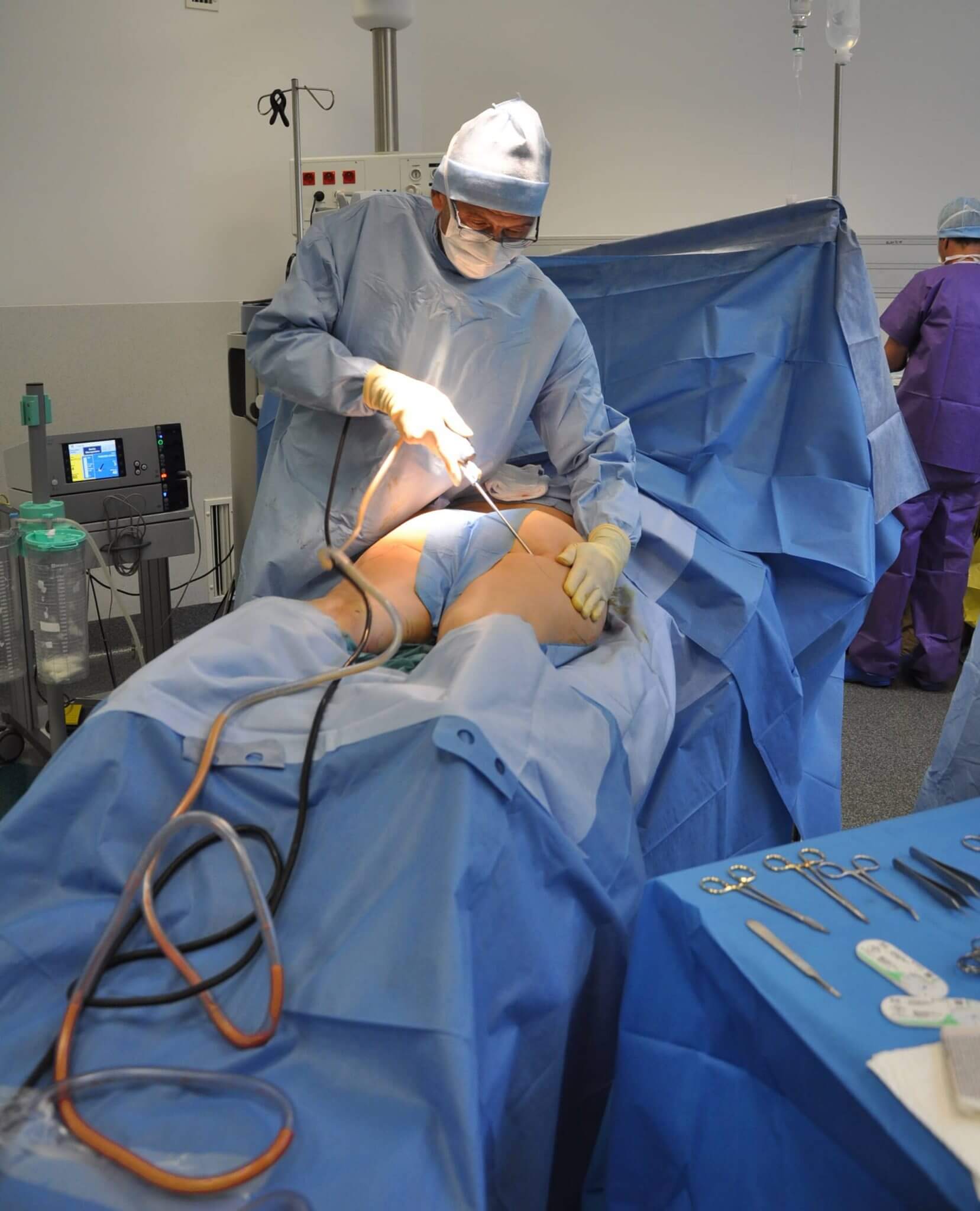 aesthetics surgeon performing a plastic surgery bbl brazilian butt lift on a patient