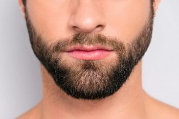 full beard men after beard hair transplant results
