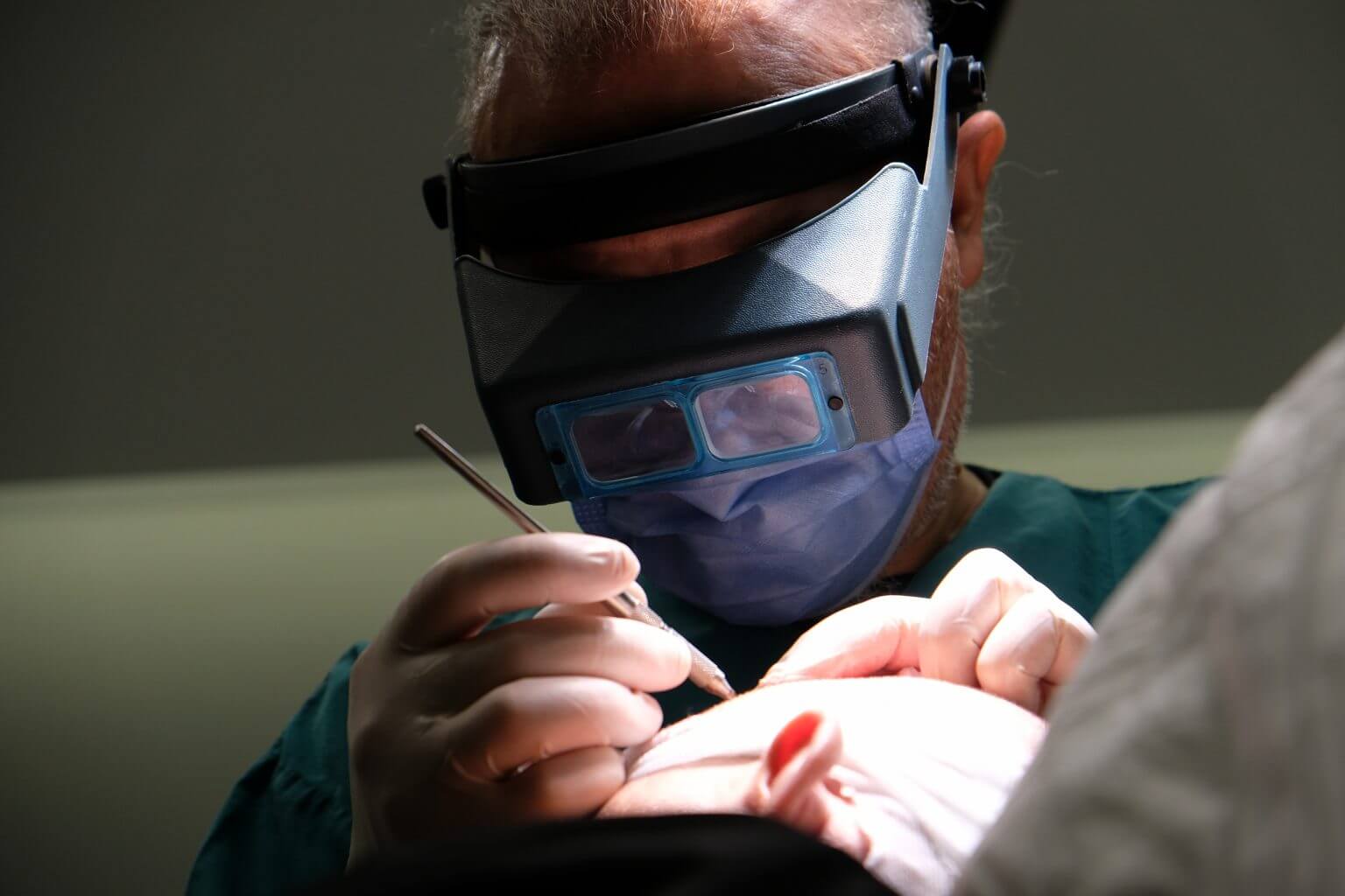 hair transplant surgeon doing a fue surgery for hair loss